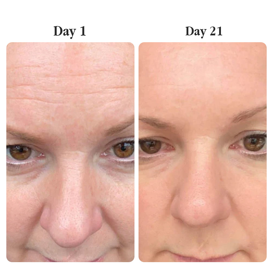 Madeca Anti-Aging Cream - The Korean Pharma Secret to Younger-Looking Skin
