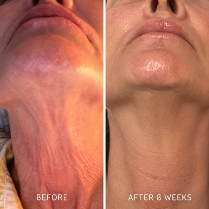 Neck Firming Cream — The Daily Cream for a Firmer, Smoother-Looking Neck