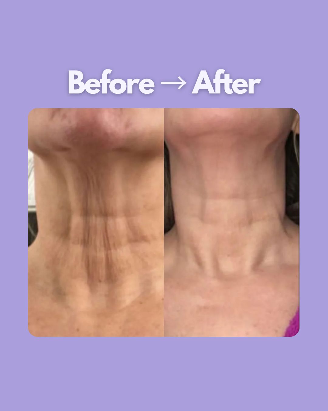 Evaura™ 7-in-1 LED Facial Sculptor