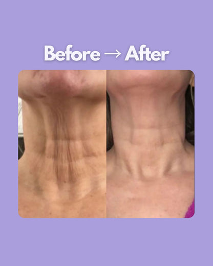 Evaura™ 7-in-1 LED Facial Sculptor