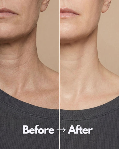 GlowNeck™ – Reusable Essential Oil Gel Neck Mask