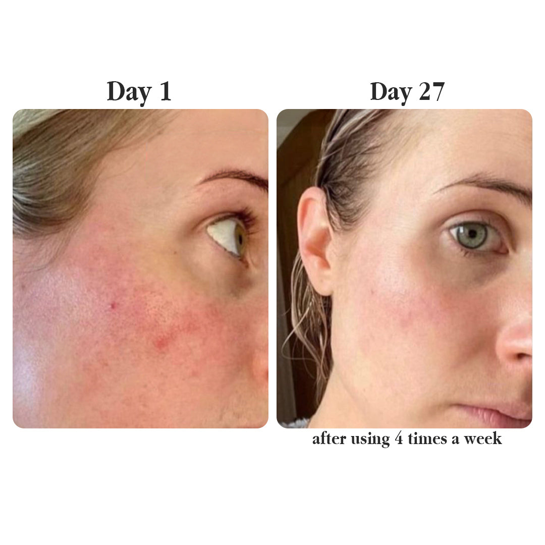 Real Collagen Fit — The Korean Peel-Off Mask for Glass-Skin Glow