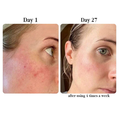 Real Collagen Fit — The Korean Peel-Off Mask for Glass-Skin Glow