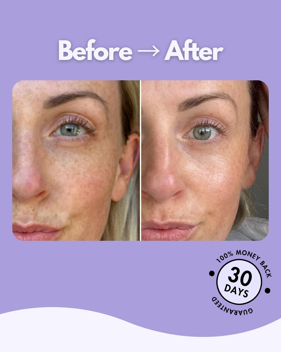 Evaura™ 7-in-1 LED Facial Sculptor