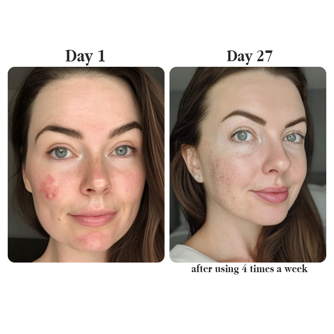 Real Collagen Fit — The Korean Peel-Off Mask for Glass-Skin Glow