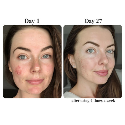 Real Collagen Fit — The Korean Peel-Off Mask for Glass-Skin Glow