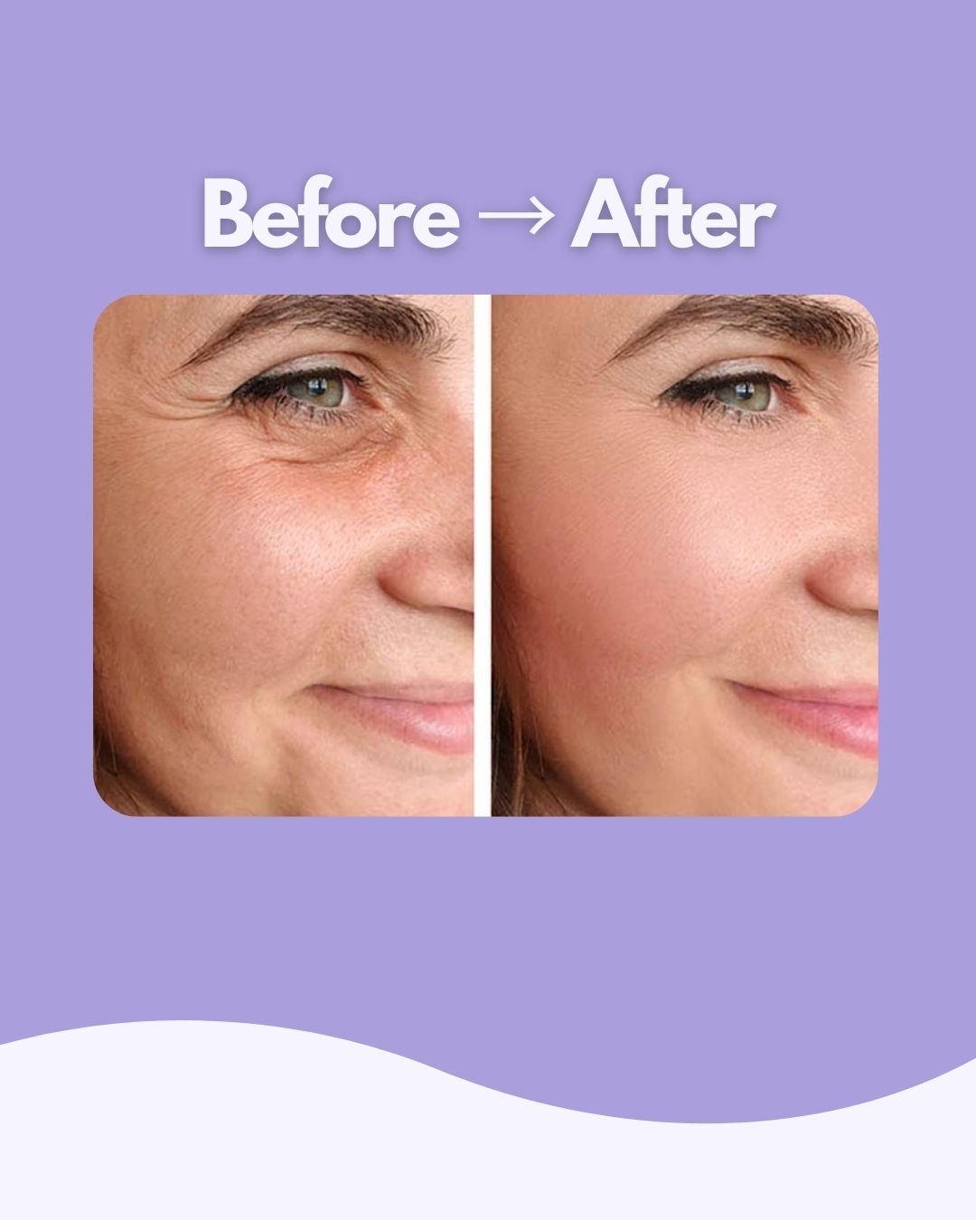 Evaura™ 7-in-1 LED Facial Sculptor