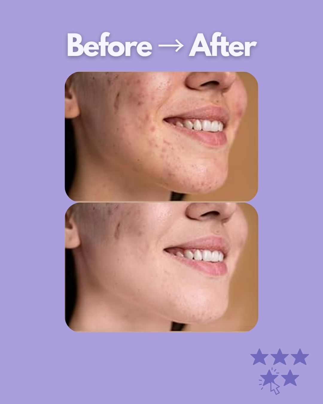 Evaura™ 7-in-1 LED Facial Sculptor