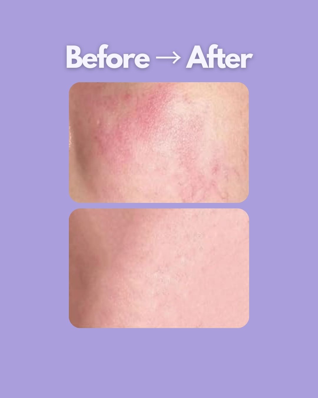 Evaura™ 7-in-1 LED Facial Sculptor