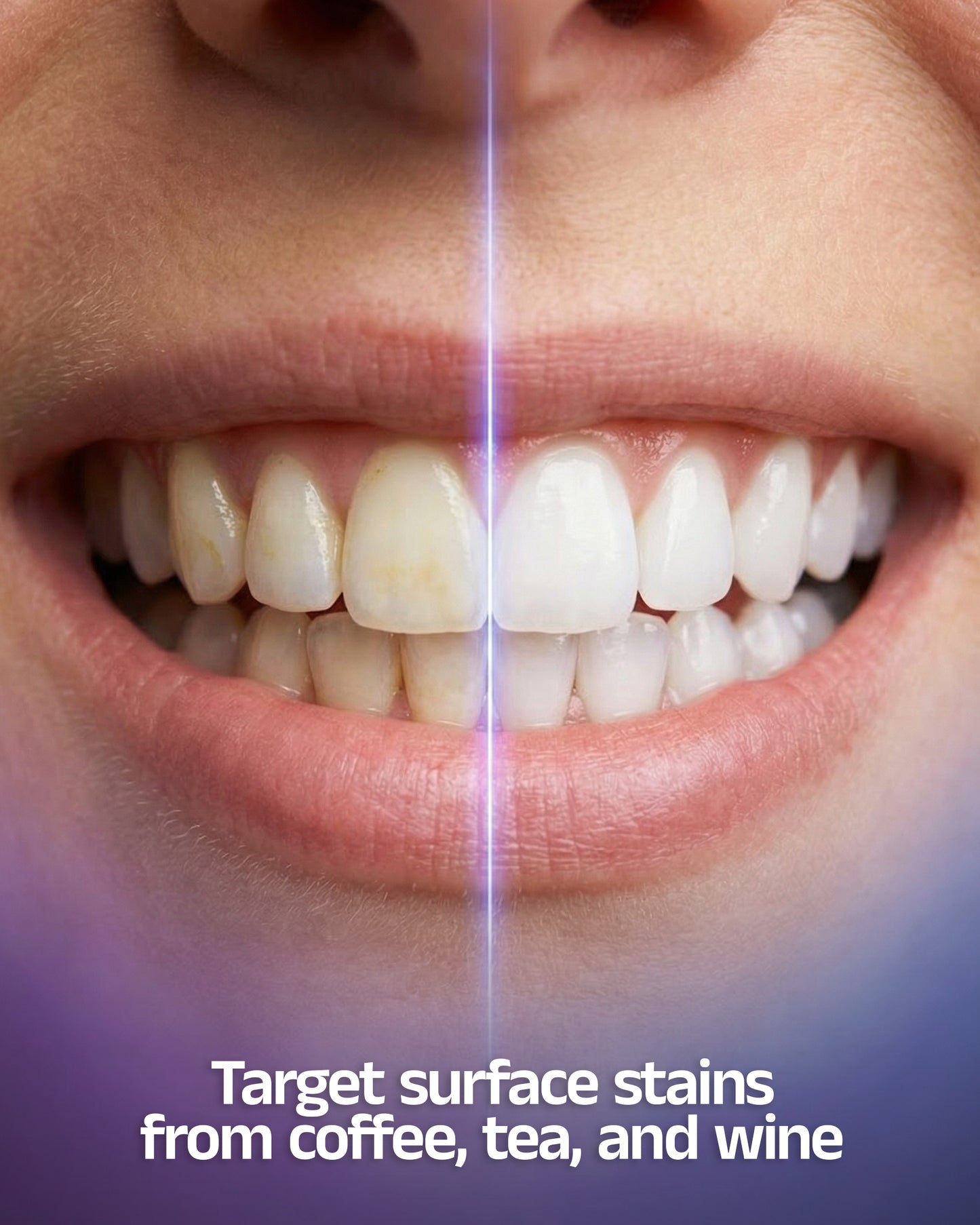 BeingOura's SmileLux® Pro