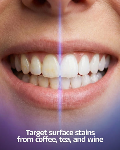 BeingOura's SmileLux® Pro