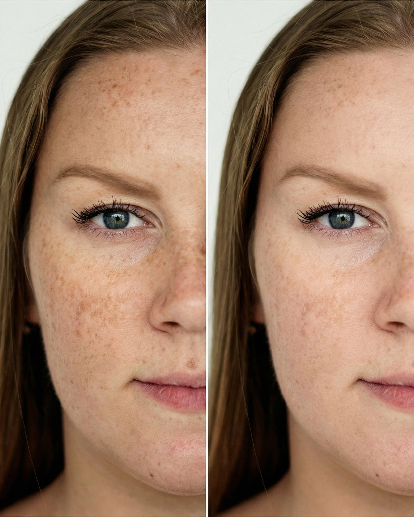 LumiAura® Pro LED Skin Renewal Mask