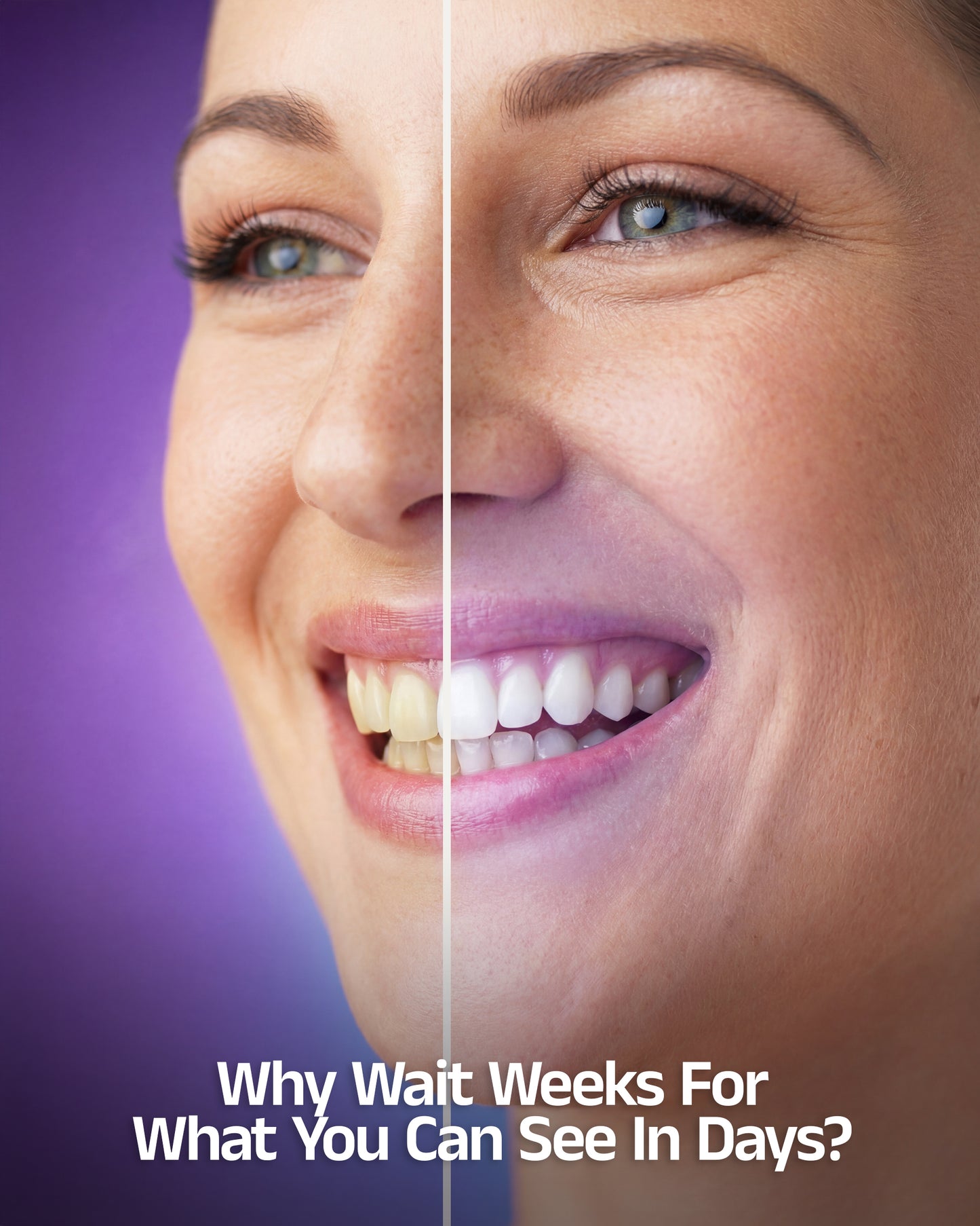 BeingOura's SmileLux® Pro