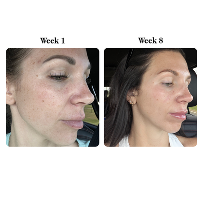 Tretinoin 0.05% — Advanced Pharma Skin Renewal