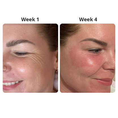 Koriderm - Korean Time Reverse Cream
