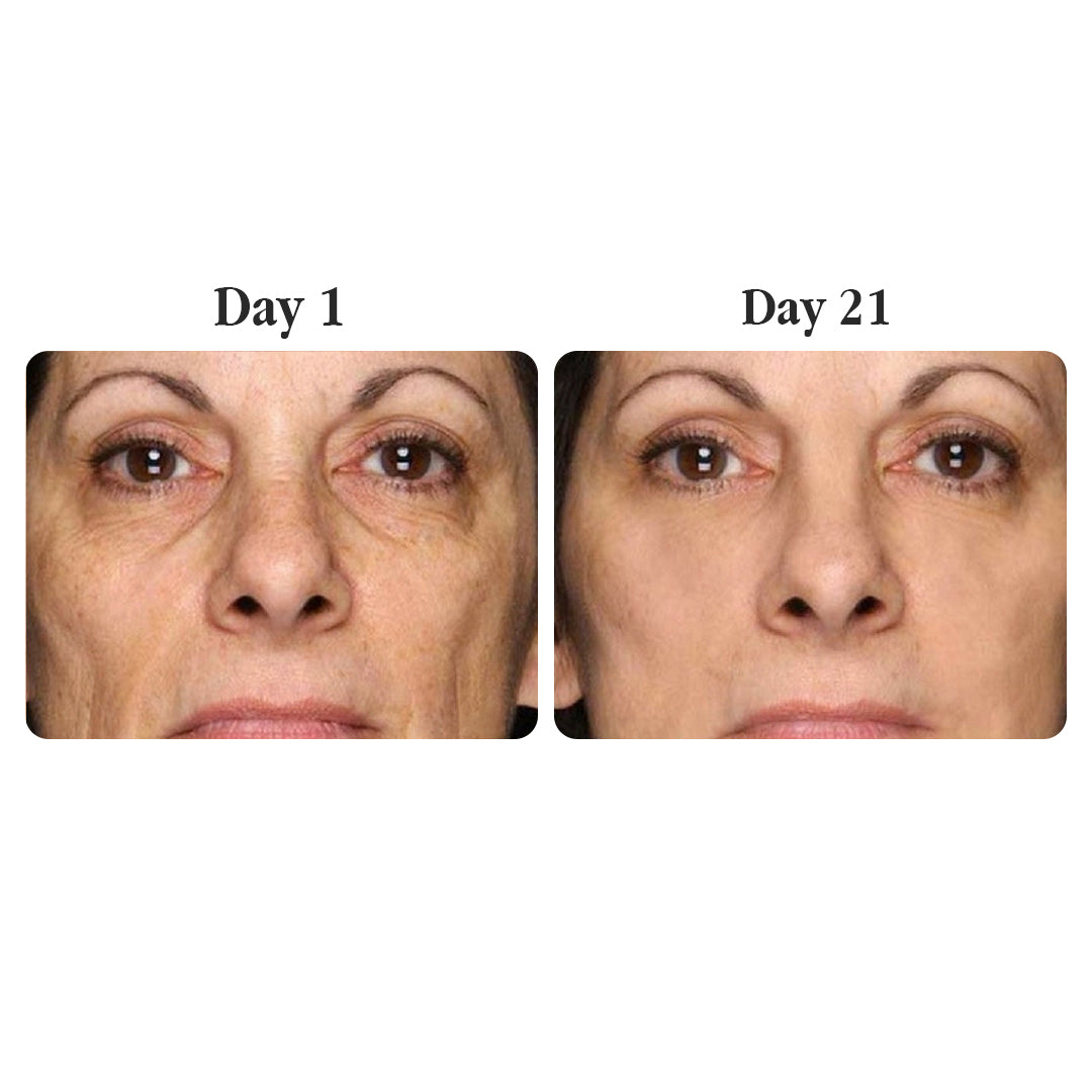 Madeca Anti-Aging Cream - The Korean Pharma Secret to Younger-Looking Skin