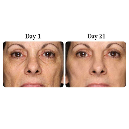 Madeca Anti-Aging Cream - The Korean Pharma Secret to Younger-Looking Skin