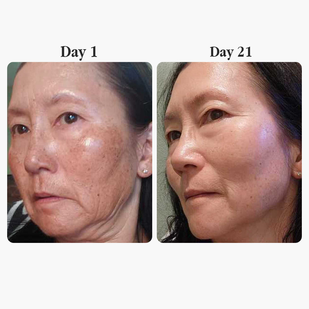 Madeca Anti-Aging Cream — Skin Barrier Repair & Calming Moisturizer