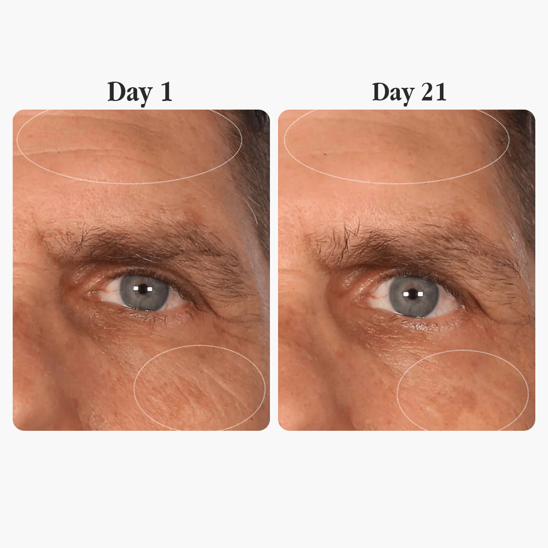 Madeca Anti-Aging Cream — Skin Barrier Repair & Calming Moisturizer