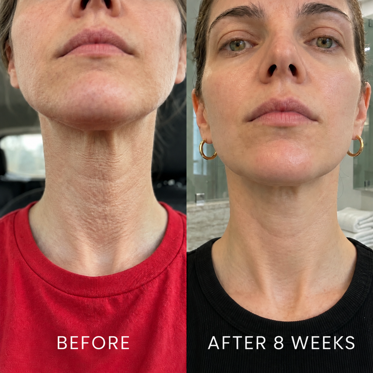 Neck Firming Cream — The Daily Cream for a Firmer, Smoother-Looking Neck