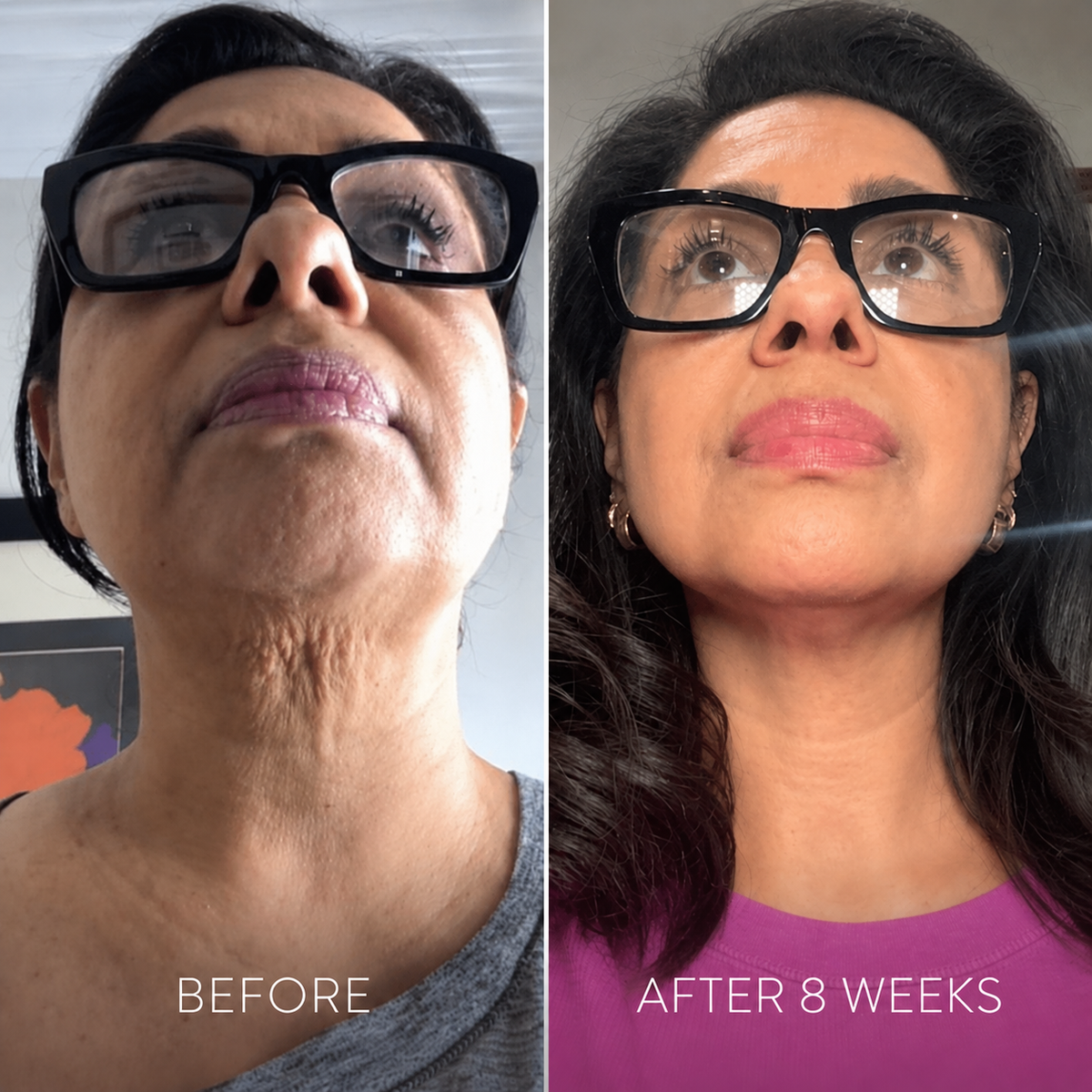 Neck Firming Cream — The Daily Cream for a Firmer, Smoother-Looking Neck