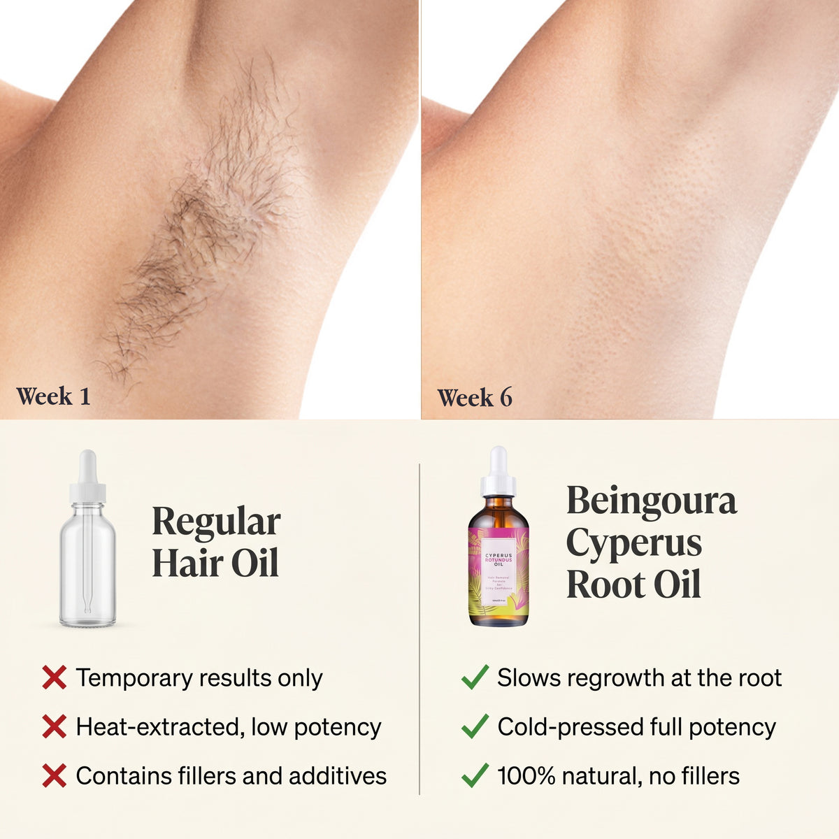 Cyperus Root Hair Inhibitor Oil — Slow Regrowth. Smoother Skin. Naturally.